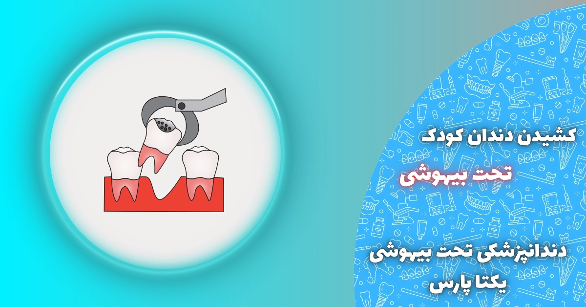 کشیدن دندان کودک بیهوشی شیراز